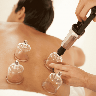 Cupping therapy and its benefits