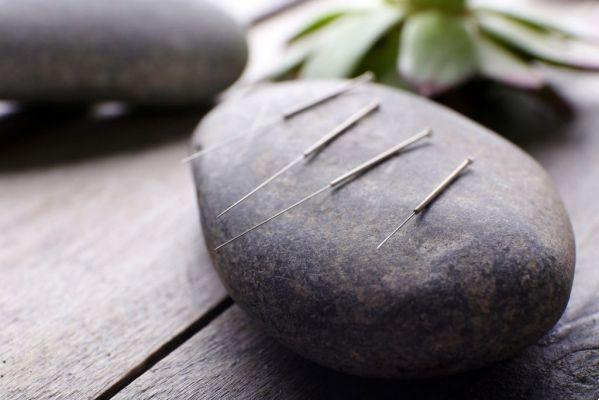 pain and acupuncture