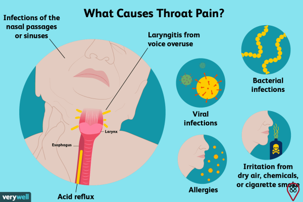 Inflammation in the throat: understand the cause of the pain