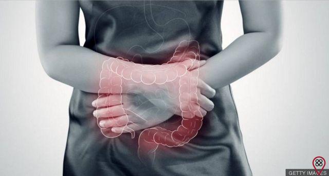 How can Holistic Therapies help in curing Irritable Bowel Syndrome?