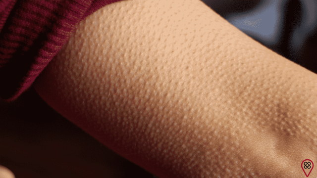 Goosebumps: how to explain this feeling that suddenly appears